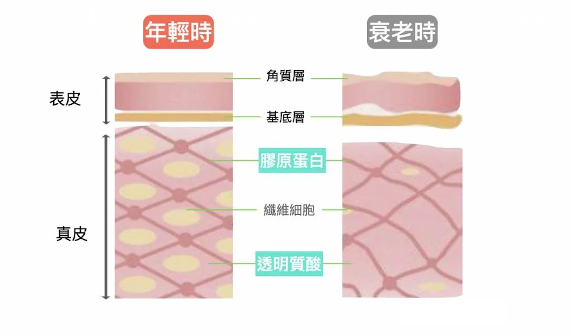 「透明質酸」和「膠原蛋白」都是皮膚細胞外基質的主要成分,關係相當密切。(圖片:ZoeSportDiary) 「透明質酸」和「膠原蛋白」都是皮膚細胞外基質的主要成分,關係相當密切。(圖片:ZoeSportDiary)