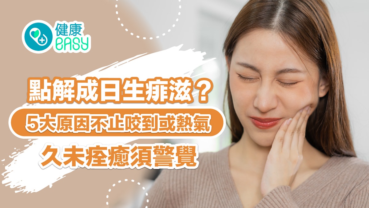 痱滋|點解成日生痱滋?5大原因不止咬到或熱氣 久未痊癒須警覺 痱滋|點解成日生痱滋?5大原因不止咬到或熱氣 久未痊癒須警覺
