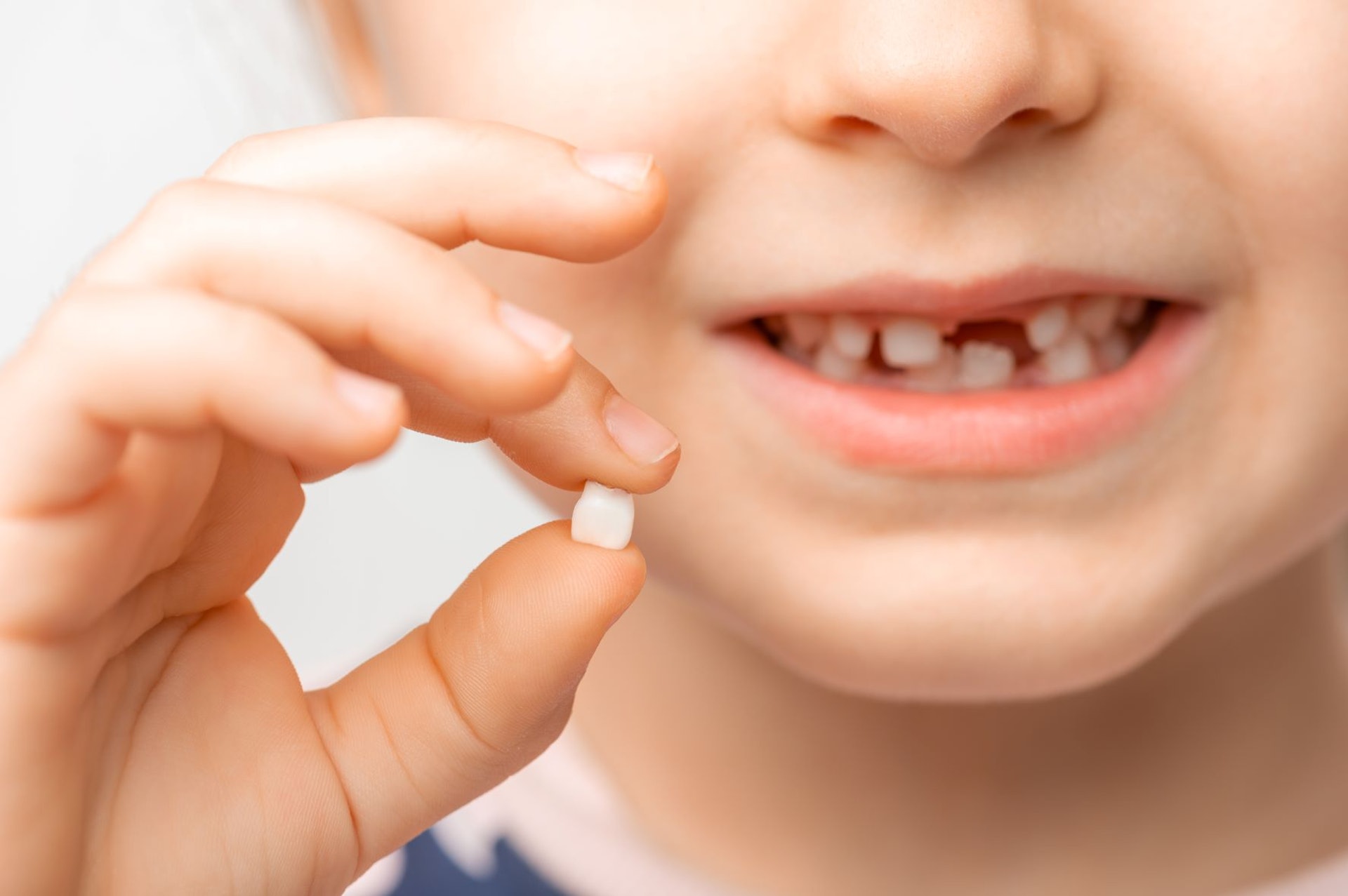 當小朋友的牙齒受到撞擊，牙齒缺角或整個斷裂時，牙齒神經可能會受到傷害並引起感染，應盡快向牙醫求醫。（圖片：Shutterstock）