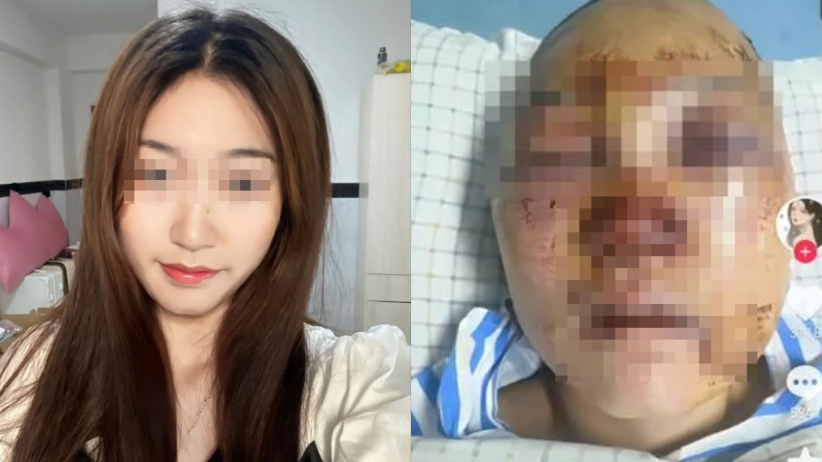 網美慘遭「挖眼拔舌」性虐 打到斷牙掉入肺 裝死任兇手猥褻保命 網美慘遭「挖眼拔舌」性虐 打到斷牙掉入肺 裝死任兇手猥褻保命
