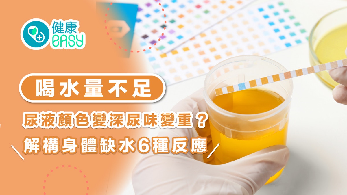 飲水｜喝水量不足尿液顏色變深尿味變重？解構身體缺水6種反應