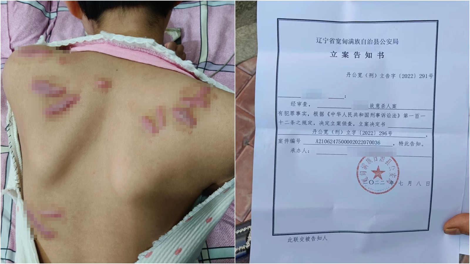 9歲女童慘遭鄰居砍傷家屬：傷人者未滿14歲刑事訴訟被撤銷