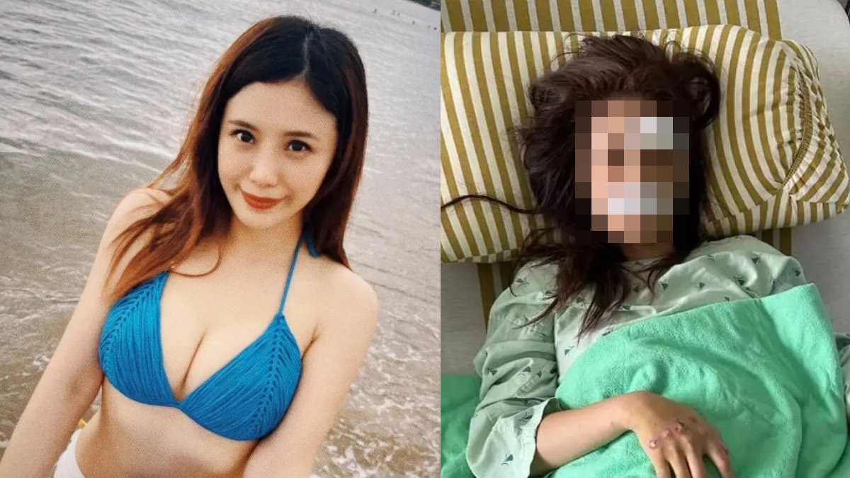 台美女主播驚傳毀容 騎單車下坡失速自摔 駭人傷勢曝光面目全非 台美女主播驚傳毀容 騎單車下坡失速自摔 駭人傷勢曝光面目全非