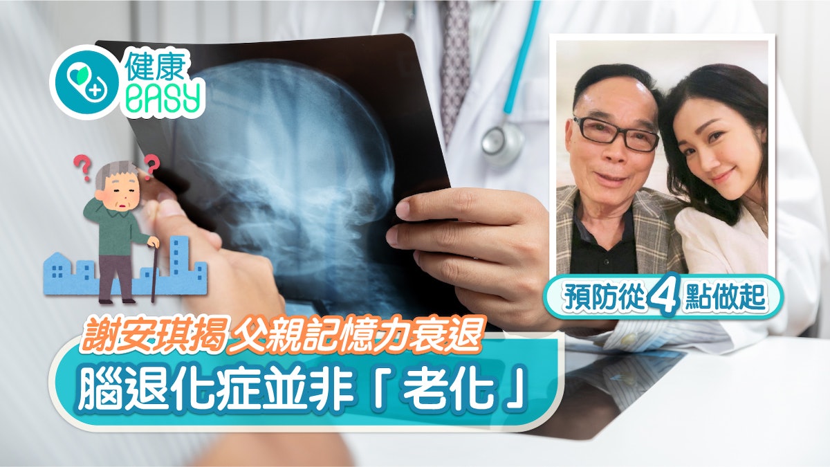 腦退化|謝安琪父親記憶衰退 腦退化症並非「老化」預防從4點做起 腦退化|謝安琪父親記憶衰退 腦退化症並非「老化」預防從4點做起