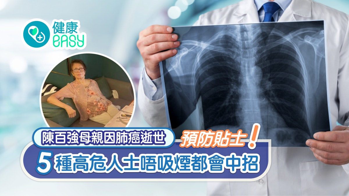 肺癌|陳百強母親因癌逝世 5種高危人士不吸煙都中招(附預防貼士) 肺癌|陳百強母親因癌逝世 5種高危人士不吸煙都中招(附預防貼士)