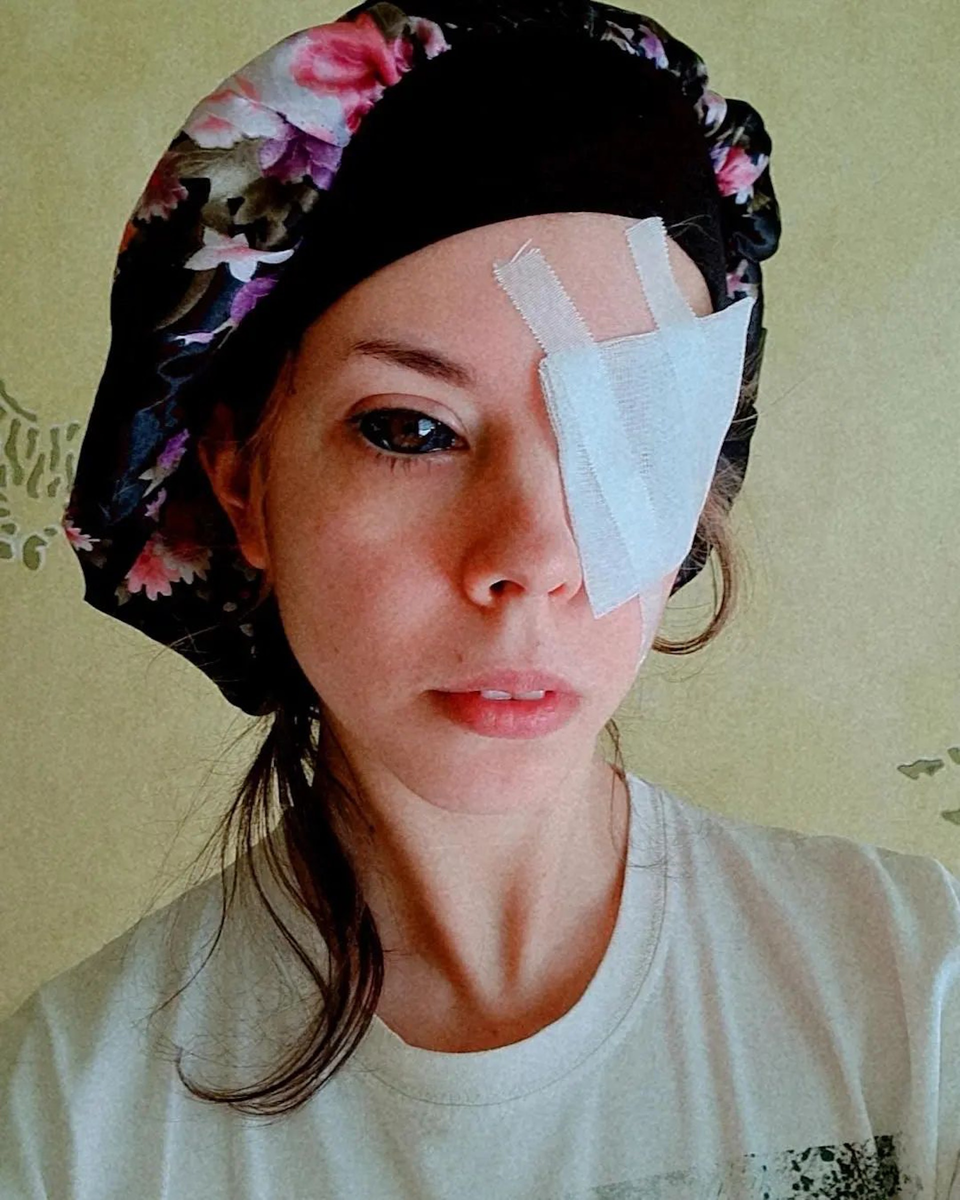 波蘭女子（Aleksandra Sadowska）於7年前請了一名自稱具豐富經驗的紋身師「Piotr. A」進行眼球紋身。（ig@anoxi_cime）