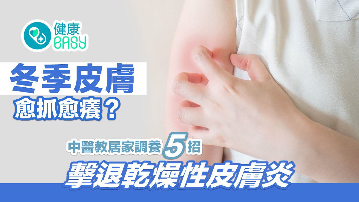 皮膚痕|冬季皮膚愈抓愈癢?中醫教居家調養5招擊退乾燥性皮膚炎 皮膚痕|冬季皮膚愈抓愈癢?中醫教居家調養5招擊退乾燥性皮膚炎