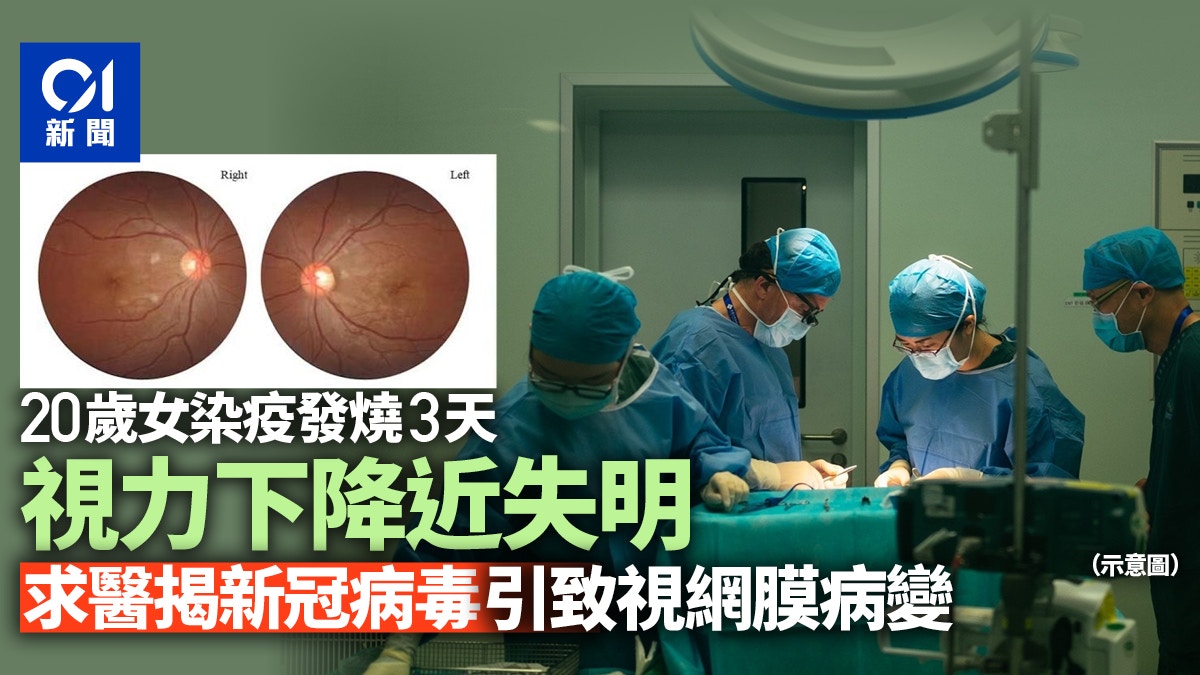 內地20歲女染疫發燒3天後近乎失明　確診為新冠引致視網膜病變