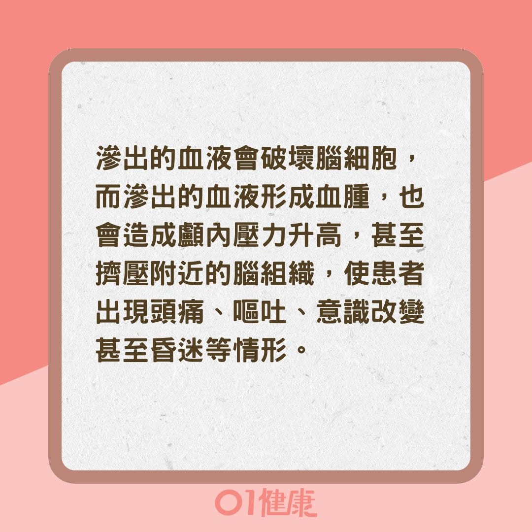 跌倒撞頭沒症狀以為沒事？（01製圖）