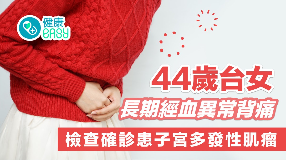 子宮肌瘤|44歲台女長期經血異常背痛 檢查確診患子宮多發性肌瘤 子宮肌瘤|44歲台女長期經血異常背痛 檢查確診患子宮多發性肌瘤