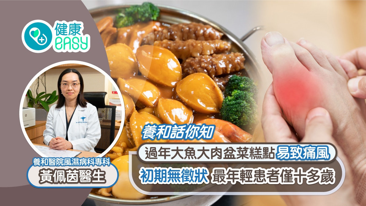 養和話你知丨過年大魚大肉易痛風　初期無徵狀最年輕患者僅十多歲