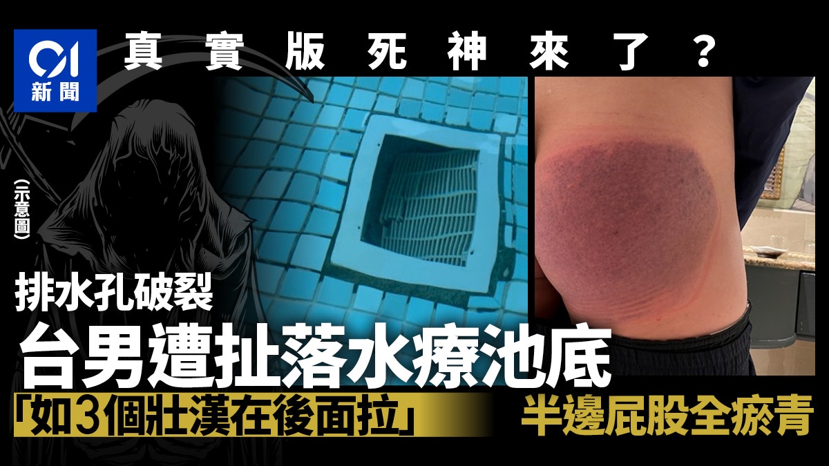 台男於酒店水療池遭水流扯至池底險遇溺　臀部大片瘀青嚇壞網友