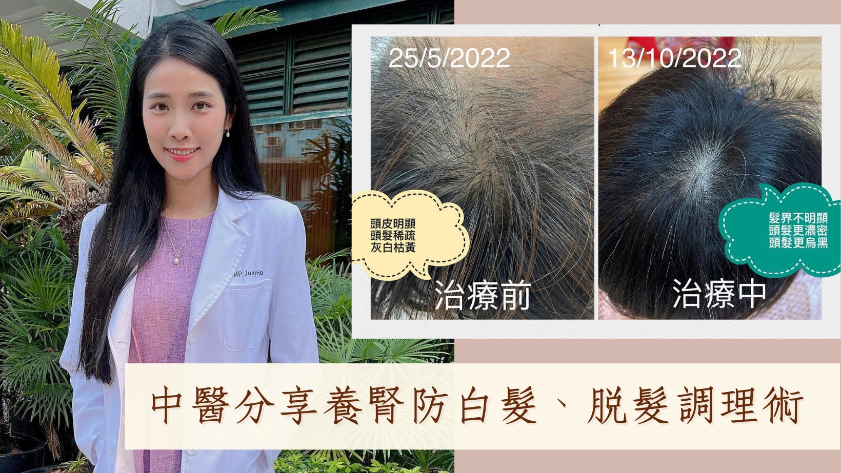 防衰老|腎血虛長白髮 中醫分享1茶2調理 60+亦能養出烏黑秀髮 防衰老|腎血虛長白髮 中醫分享1茶2調理 60+亦能養出烏黑秀髮