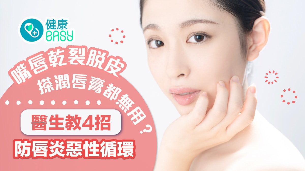 嘴唇乾|嘴唇乾裂脫皮搽潤唇膏都無用?醫生教4招防唇炎惡性循環 嘴唇乾|嘴唇乾裂脫皮搽潤唇膏都無用?醫生教4招防唇炎惡性循環