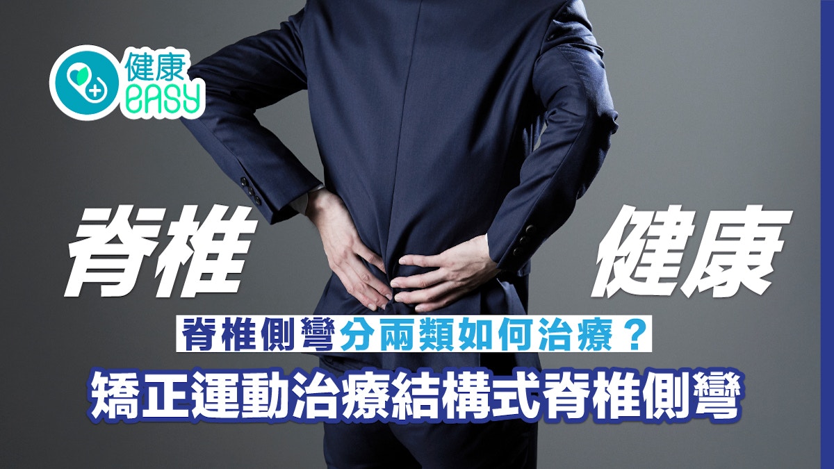 脊椎健康｜脊椎側彎分兩類如何治療？矯正運動治療結構式脊椎側彎