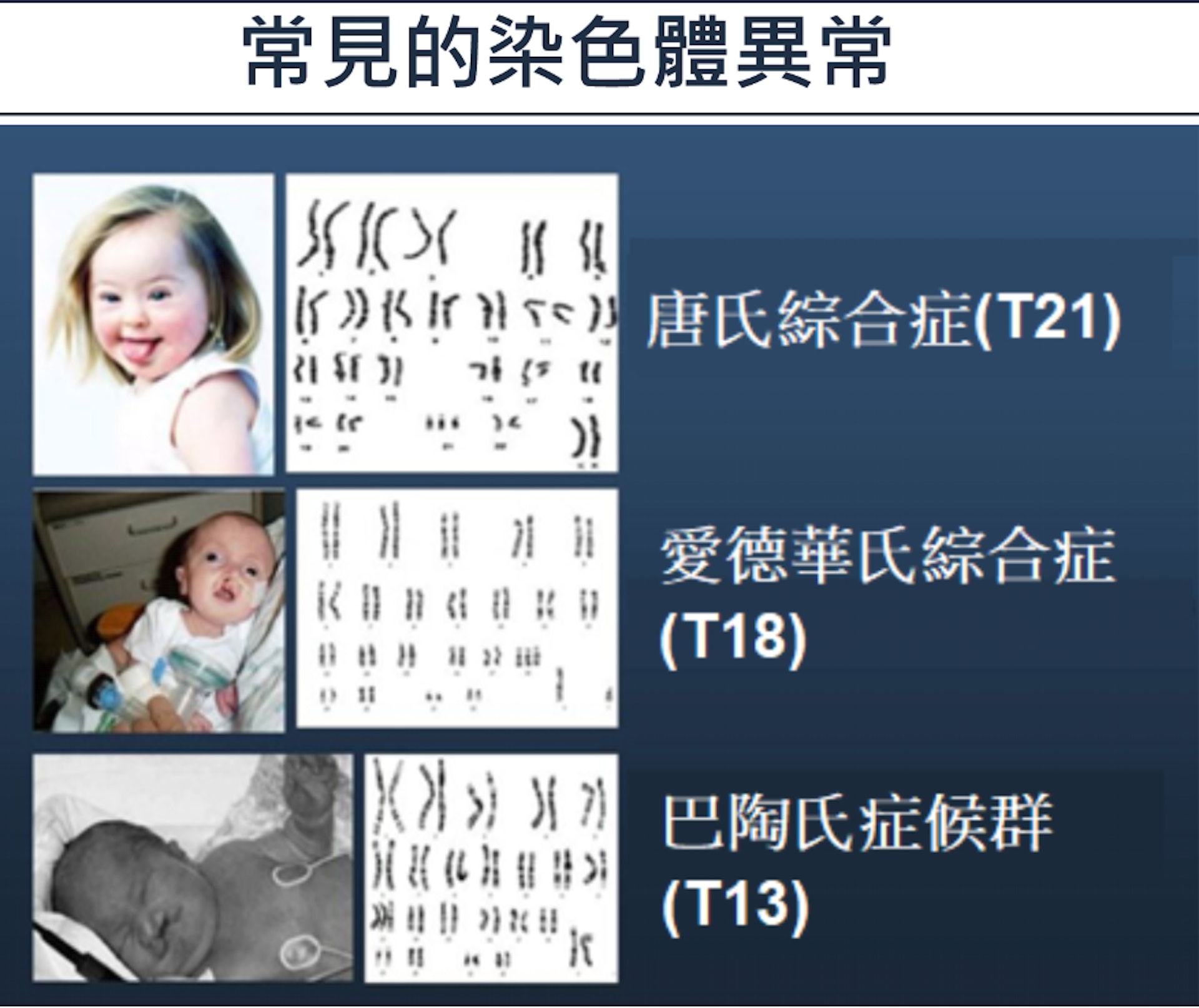 即使染色體數量正確,沒有缺失或過多,任何一條染色體出現小部分的遺傳資料缺失或增長,誕下的胎兒亦可能出現不同症狀或缺陷。故孕婦更應先做檢測,以保障胎兒及媽媽的健康,一旦發現異常便盡早處理。 即使染色體數量正確,沒有缺失或過多,任何一條染色體出現小部分的遺傳資料缺失或增長,誕下的胎兒亦可能出現不同症狀或缺陷。故孕婦更應先做檢測,以保障胎兒及媽媽的健康,一旦發現異常便盡早處理。