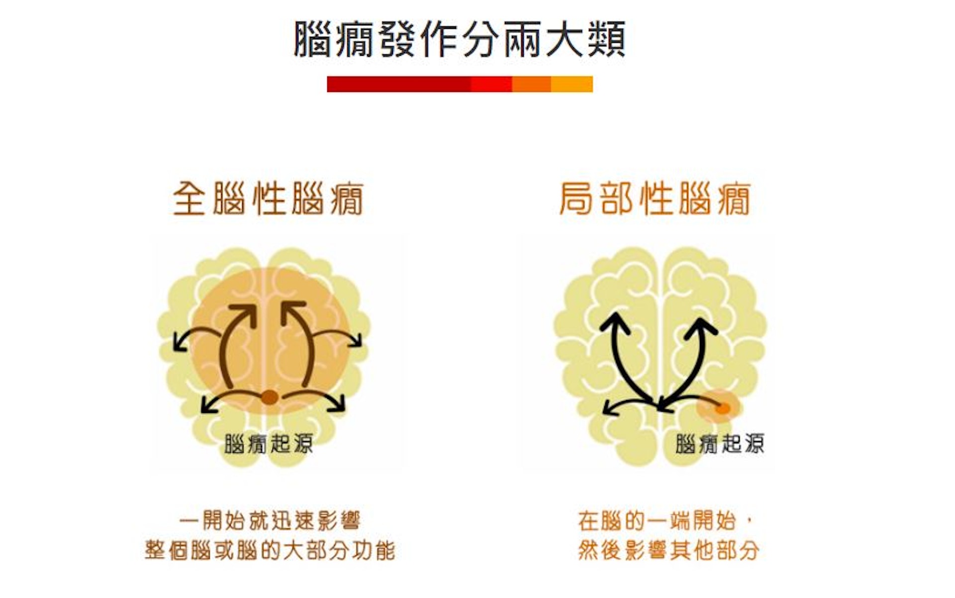 「癲癇」又稱「腦癇症」,是神經系統疾病,主要分兩大類。(香港腦癇基金會) 「癲癇」又稱「腦癇症」,是神經系統疾病,主要分兩大類。(香港腦癇基金會)