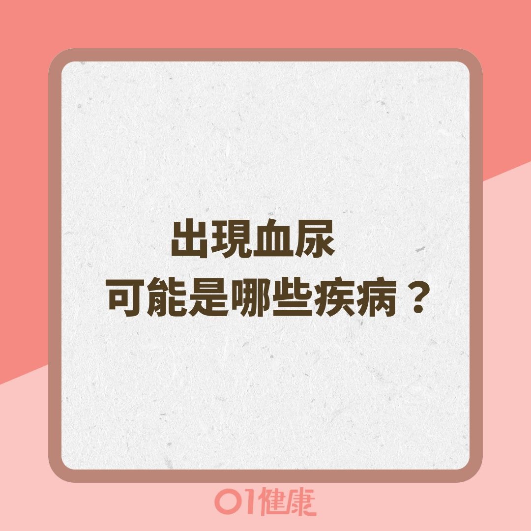 出現血尿可能是哪些疾病？（01製圖 ）