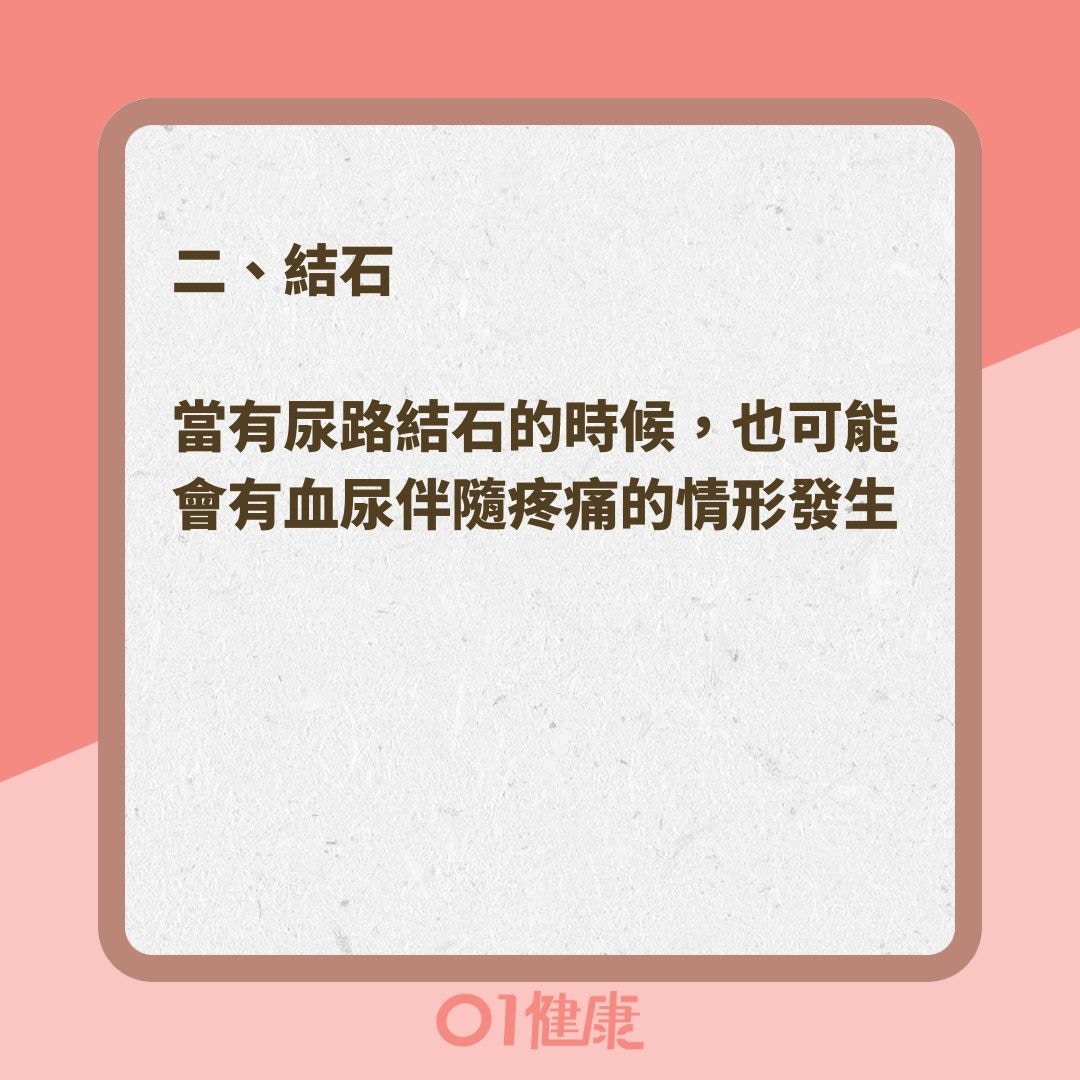 出現血尿可能是哪些疾病？（01製圖 ）