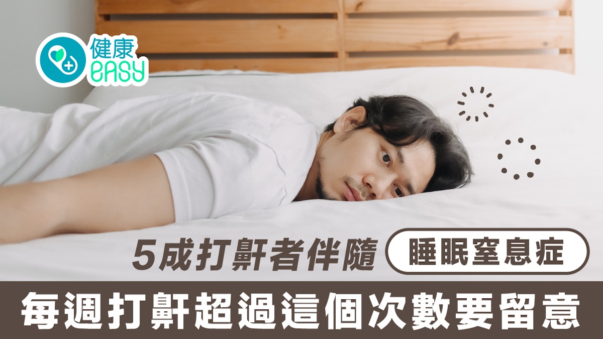 鼻鼾|5成打鼾者伴隨睡眠窒息症 每週打鼾超過這個次數要留意