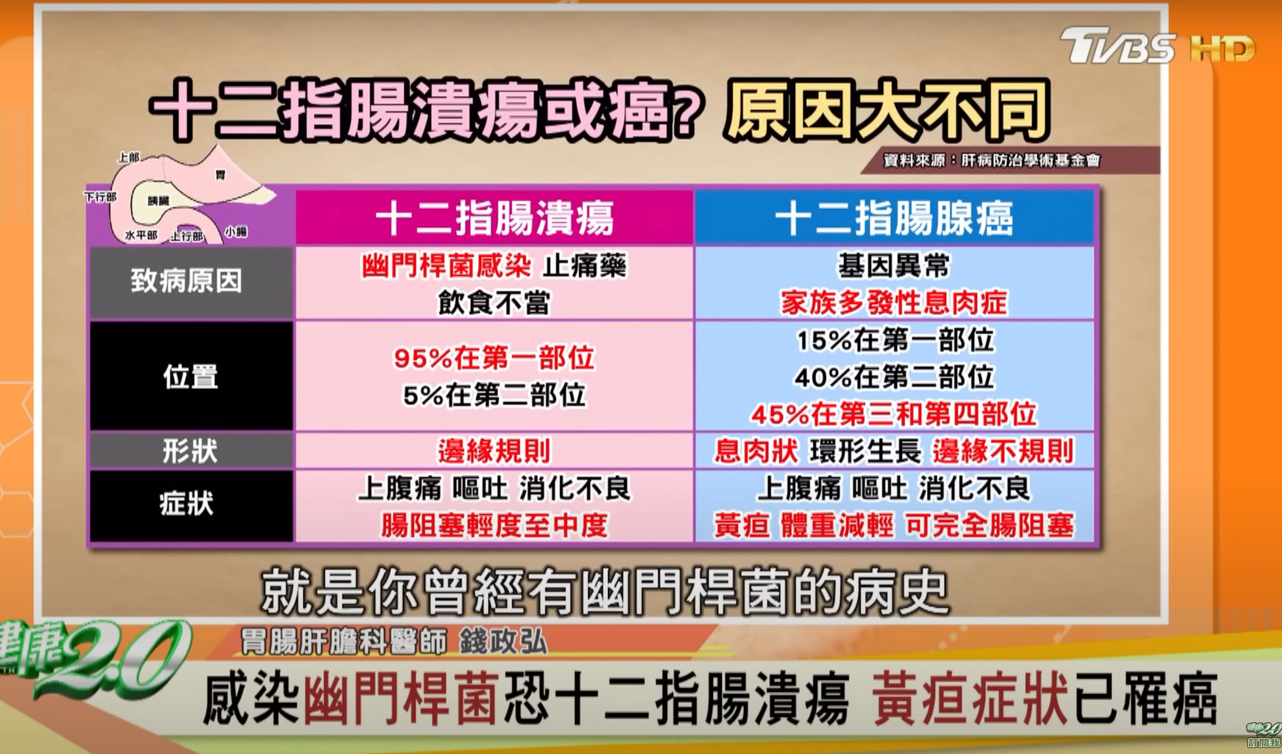 消化不良原因｜錢醫師提醒12指腸致病的分別，要當心徵症！（截自Youtube 《健康2.0》）