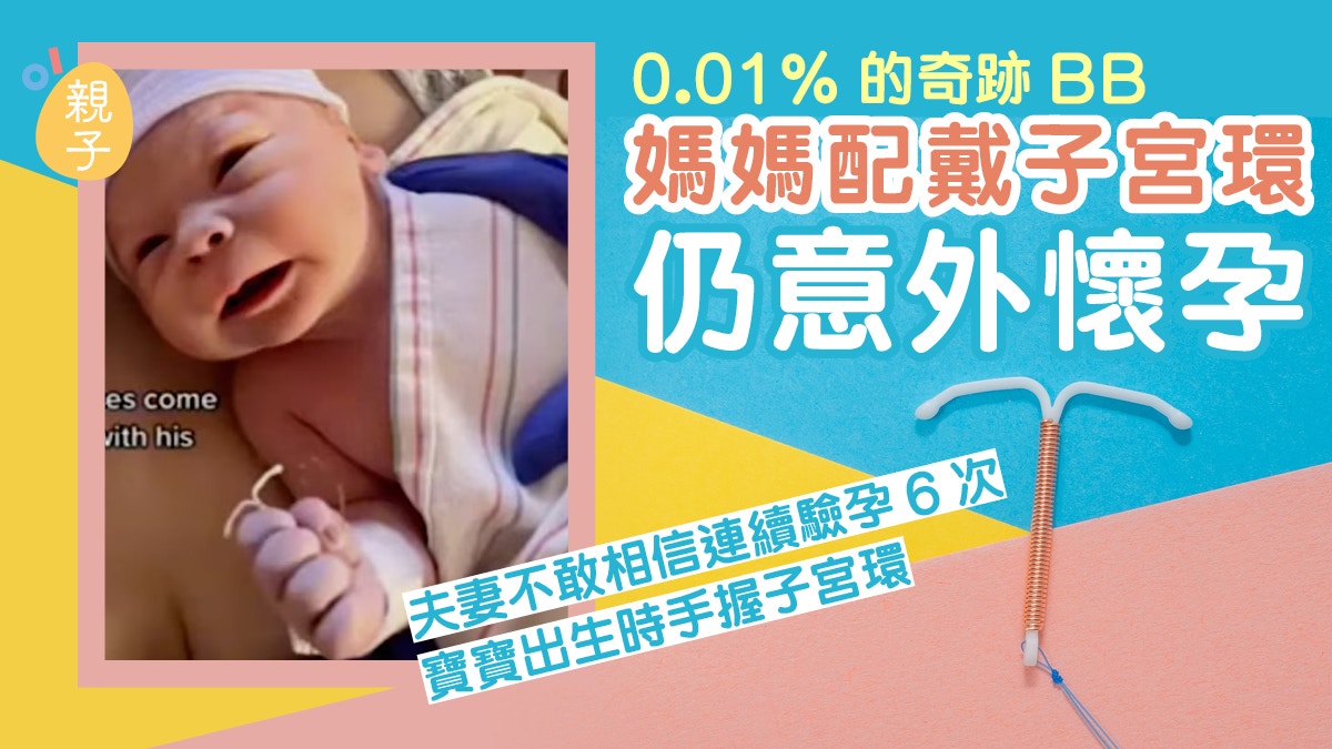 0.01%的奇跡Bb 媽媽配戴子宮環仍意外懷孕寶寶出生時手握子宮環