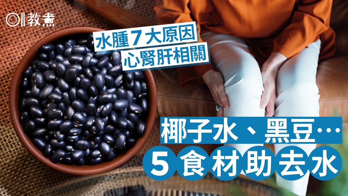 水腫|心臟肝腎有事皆可導致 椰子水、黑豆5大食材有助身體去水 水腫|心臟肝腎有事皆可導致 椰子水、黑豆5大食材有助身體去水