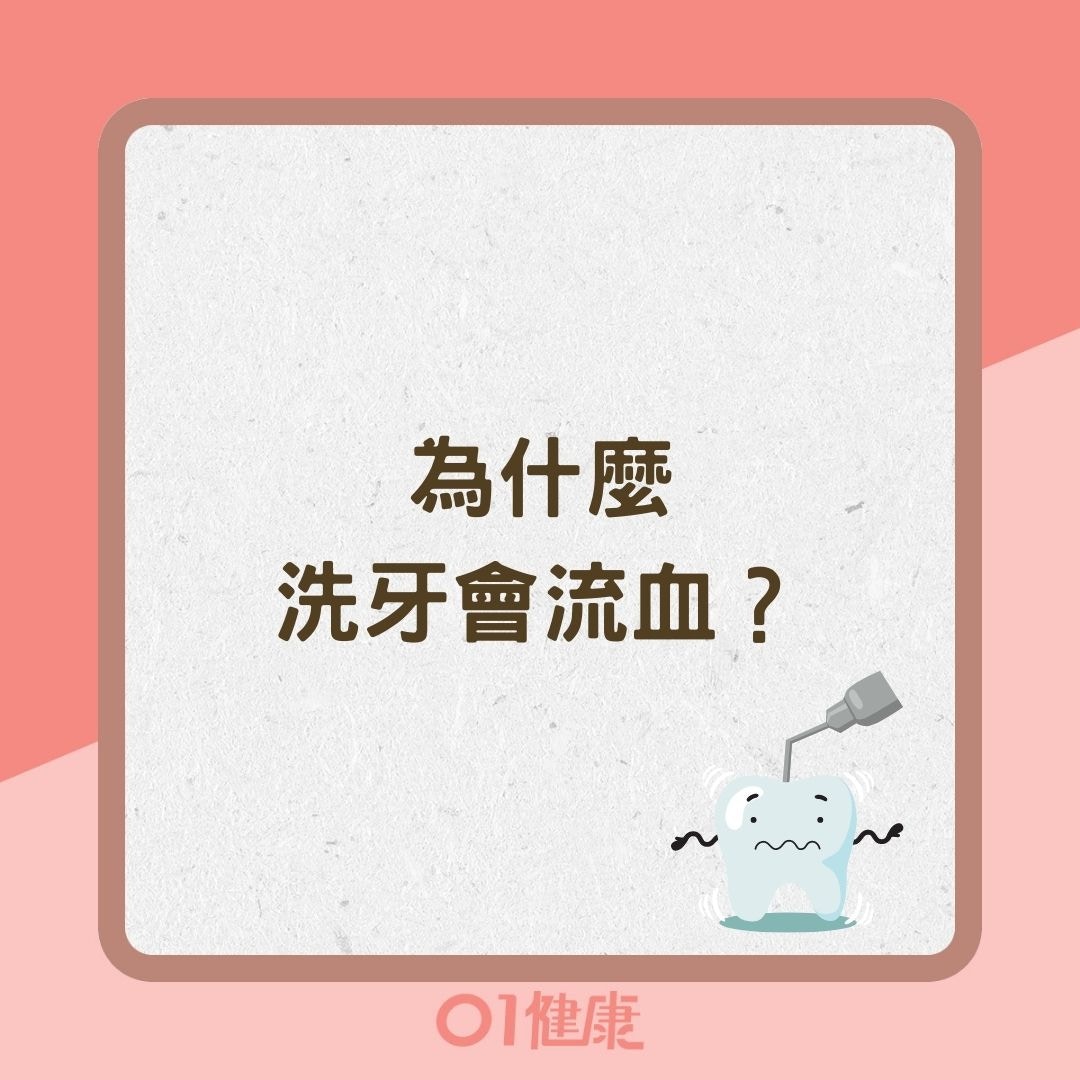 為什麼洗牙會流血？（01製圖）