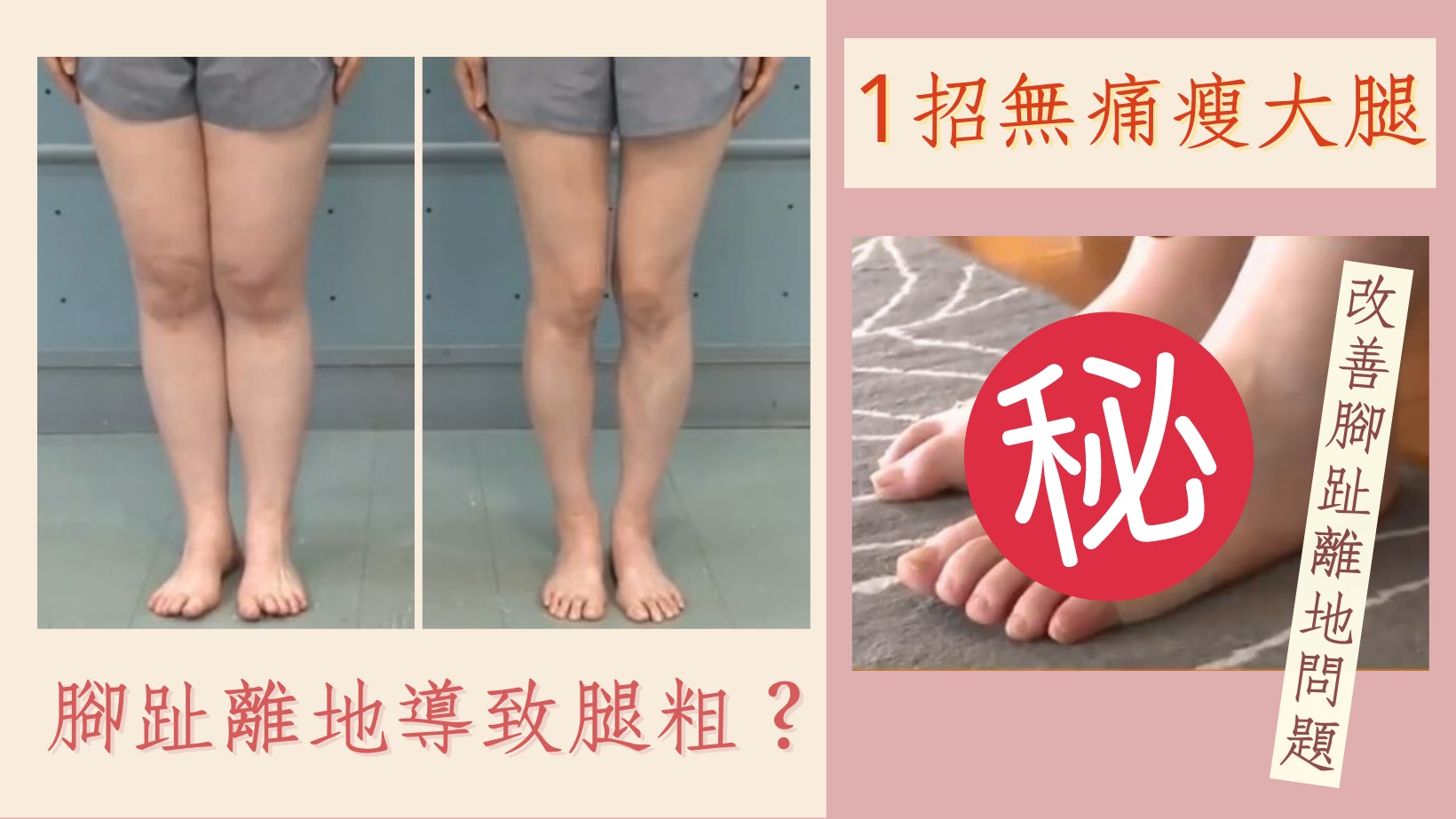 減大象腿|腳趾影響大腿粗幼?腳背貼上1物 腿圍2週無痛減1.8cm 減大象腿|腳趾影響大腿粗幼?腳背貼上1物 腿圍2週無痛減1.8cm