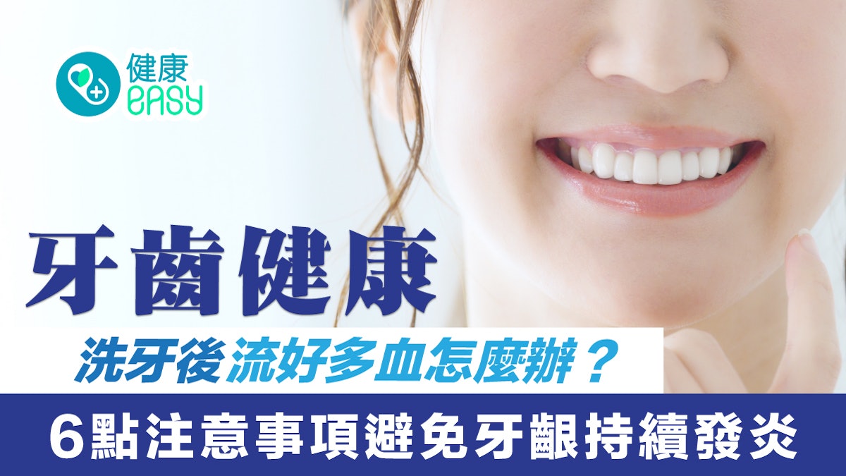 牙齒健康|洗牙後流好多血怎麼辦?6點注意事項避免牙齦持續發炎 牙齒健康|洗牙後流好多血怎麼辦?6點注意事項避免牙齦持續發炎
