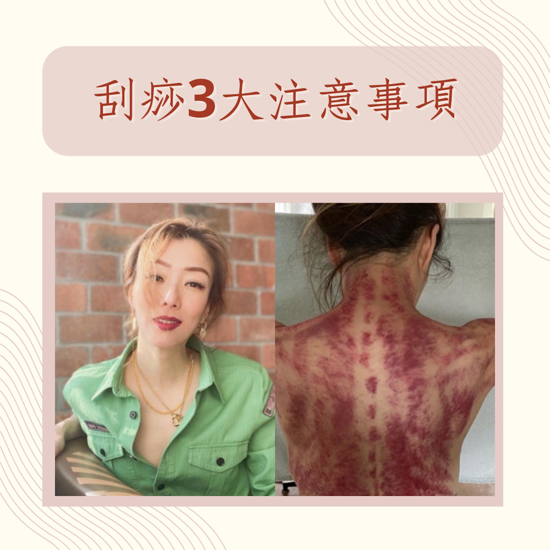 刮痧3大注意事項(IG@sammi_chengsauman;01製圖) 刮痧3大注意事項(IG@sammi_chengsauman;01製圖)