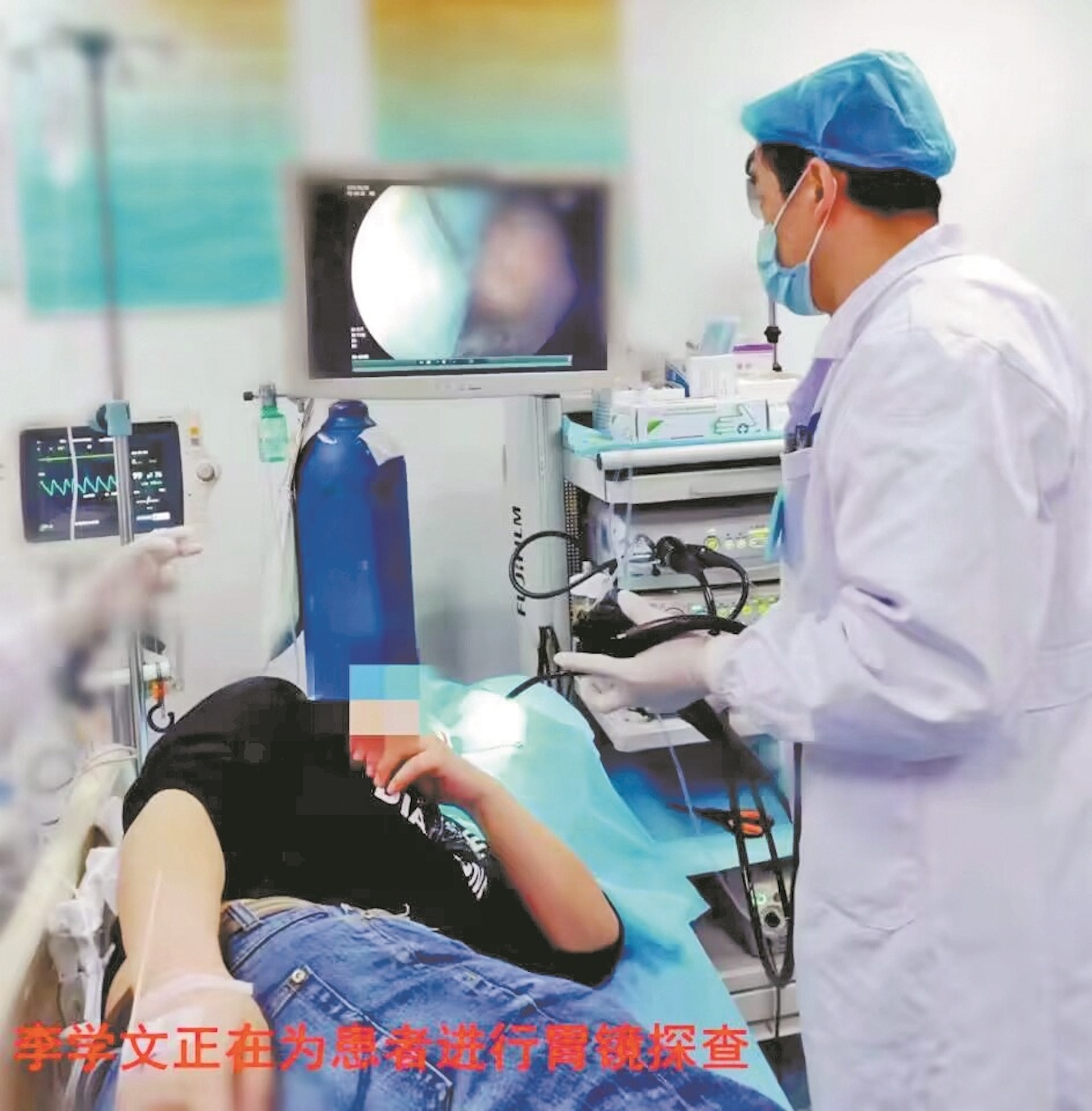 姚先生被兒子把20厘米長的玩具士巴拿塞入口並吞下,到醫院時已落到十二指腸位置,醫生當機立斷即時用胃鏡取出,全程花了10分鐘。(微博圖片)