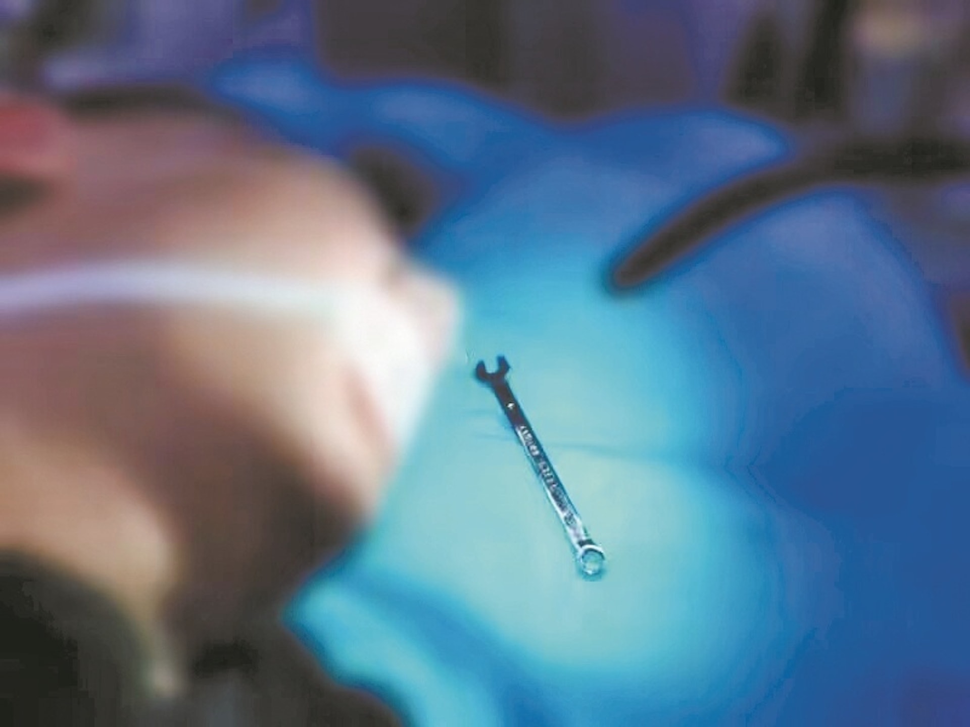 玩具士巴拿有20厘米長,醫生指如停留在身體過久,最嚴重可危及性命。(微博圖片)