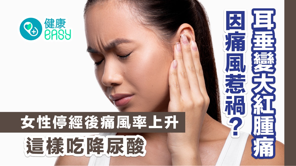 耳垂變大紅腫痛因痛風惹禍?女性停經後痛風率上升 這樣吃降尿酸 耳垂變大紅腫痛因痛風惹禍?女性停經後痛風率上升 這樣吃降尿酸