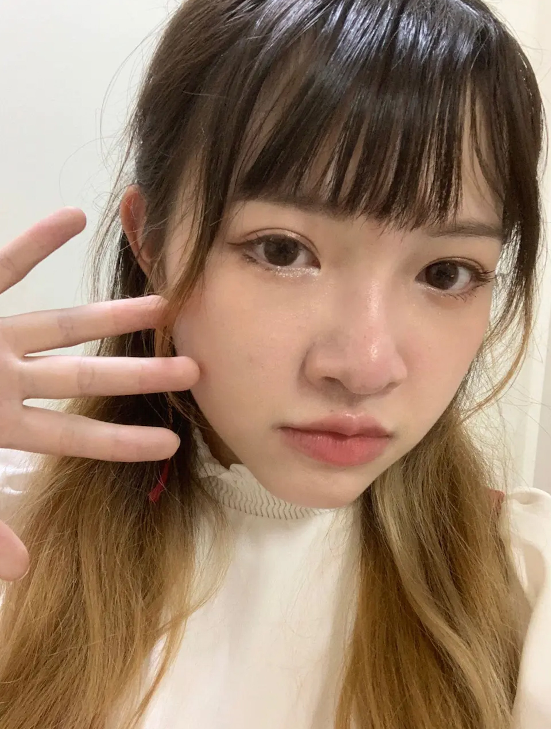 兒童時期沒有長過水痘,就以為逃過一劫,但原來成年還是有機會感染水痘。(Dcard) 兒童時期沒有長過水痘,就以為逃過一劫,但原來成年還是有機會感染水痘。(Dcard)