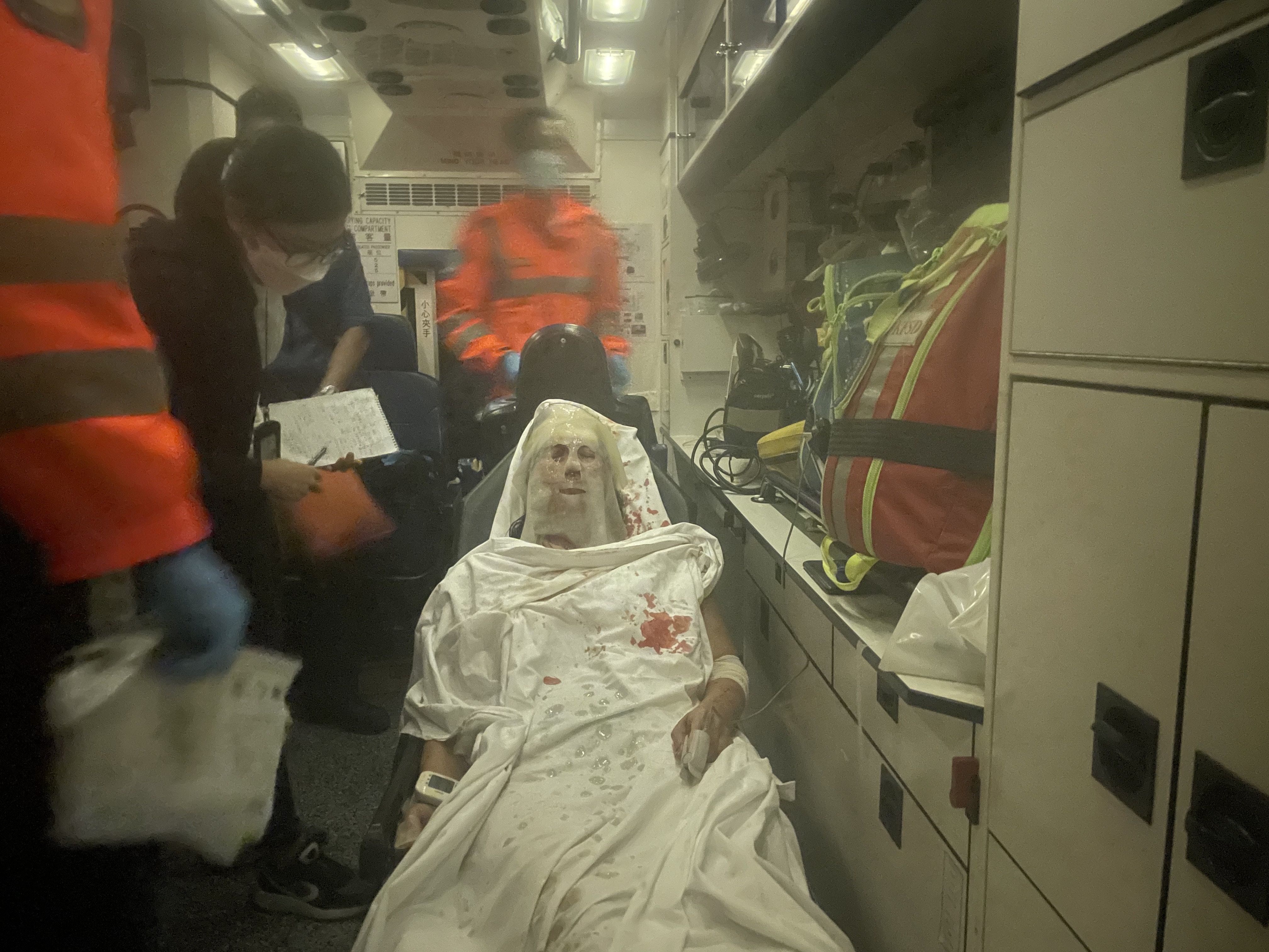 被告的妻子及女兒均有燙傷及刀傷。(資料圖片) 被告的妻子及女兒均有燙傷及刀傷。(資料圖片)