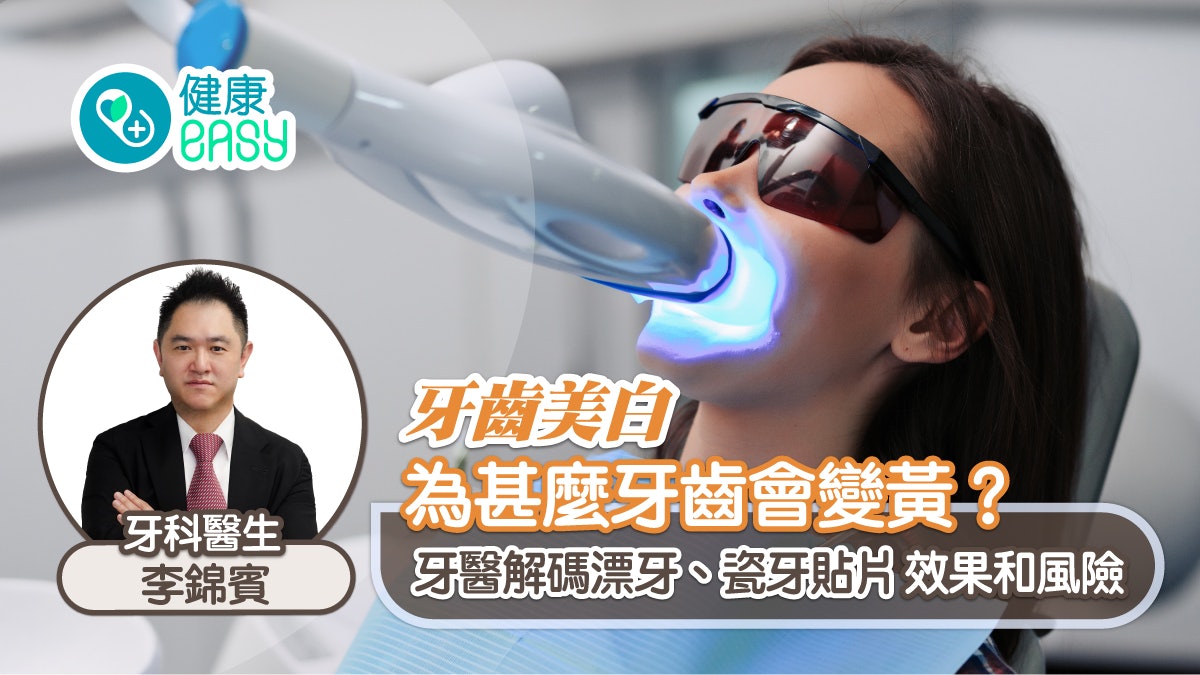 牙齒美白丨為甚麼牙齒會變黃?牙醫解碼漂牙、瓷牙貼片效果和風險 牙齒美白丨為甚麼牙齒會變黃?牙醫解碼漂牙、瓷牙貼片效果和風險