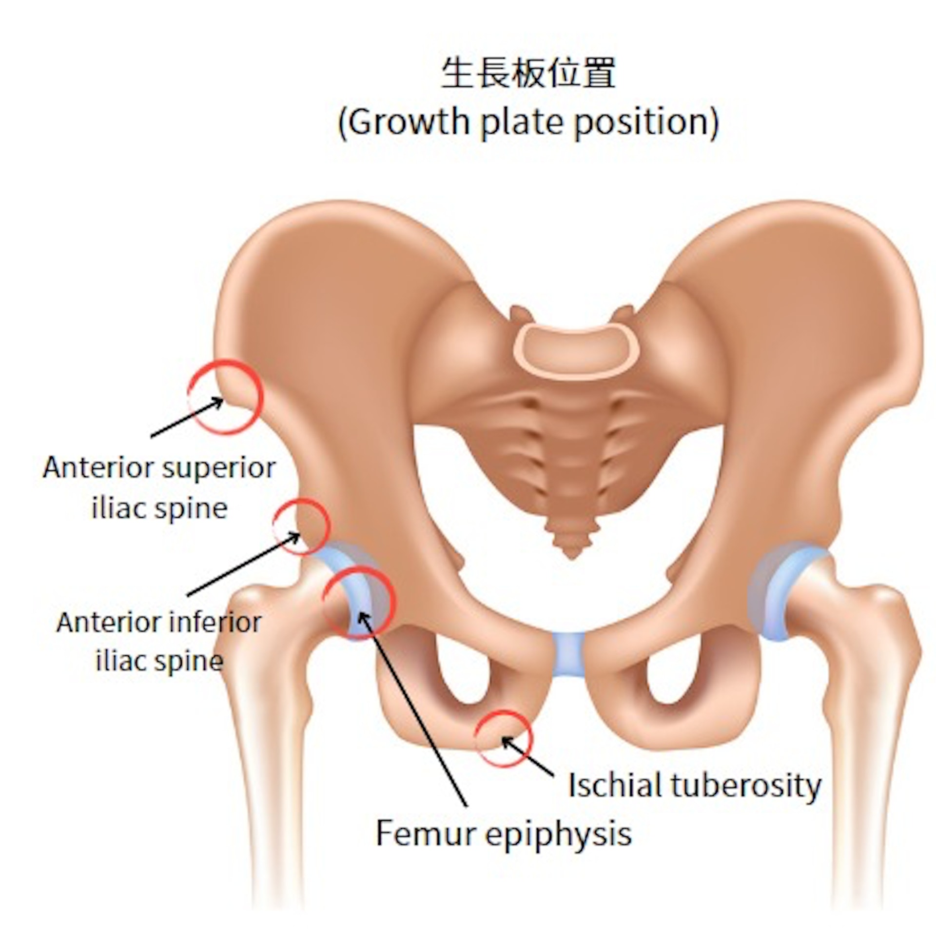 發育中的兒童及青少年骨骼生長板尚未閉合，受到髖部創傷的同時，會因生長板受創進而有機會影響身高發育。（圖片：Shutterstock）