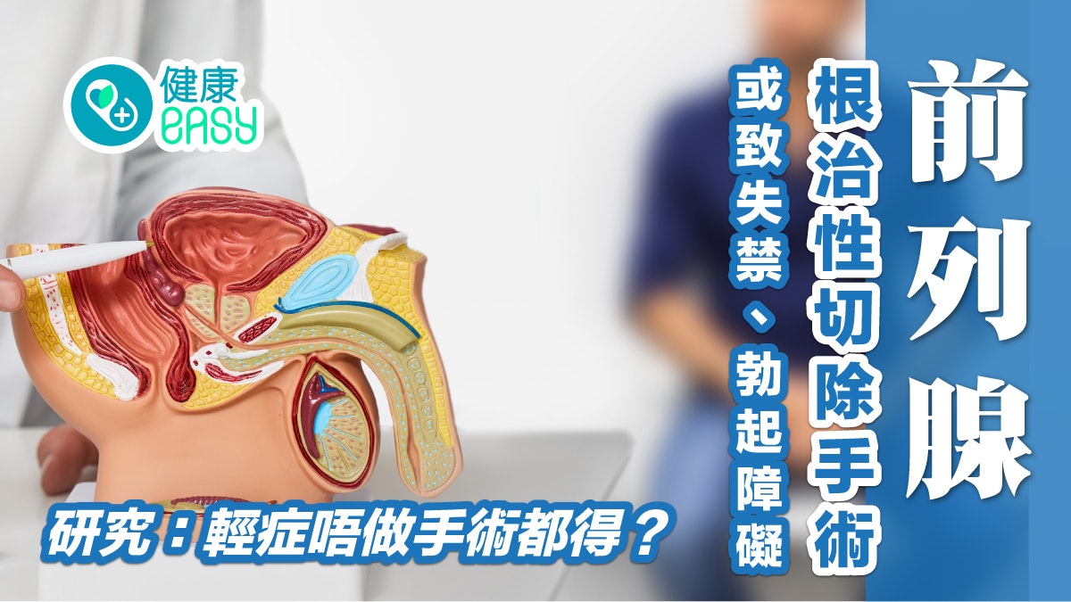 前列腺癌|失禁、逆行射精 前列腺手術後遺多 患癌唔做手術都得? 前列腺癌|失禁、逆行射精 前列腺手術後遺多 患癌唔做手術都得?