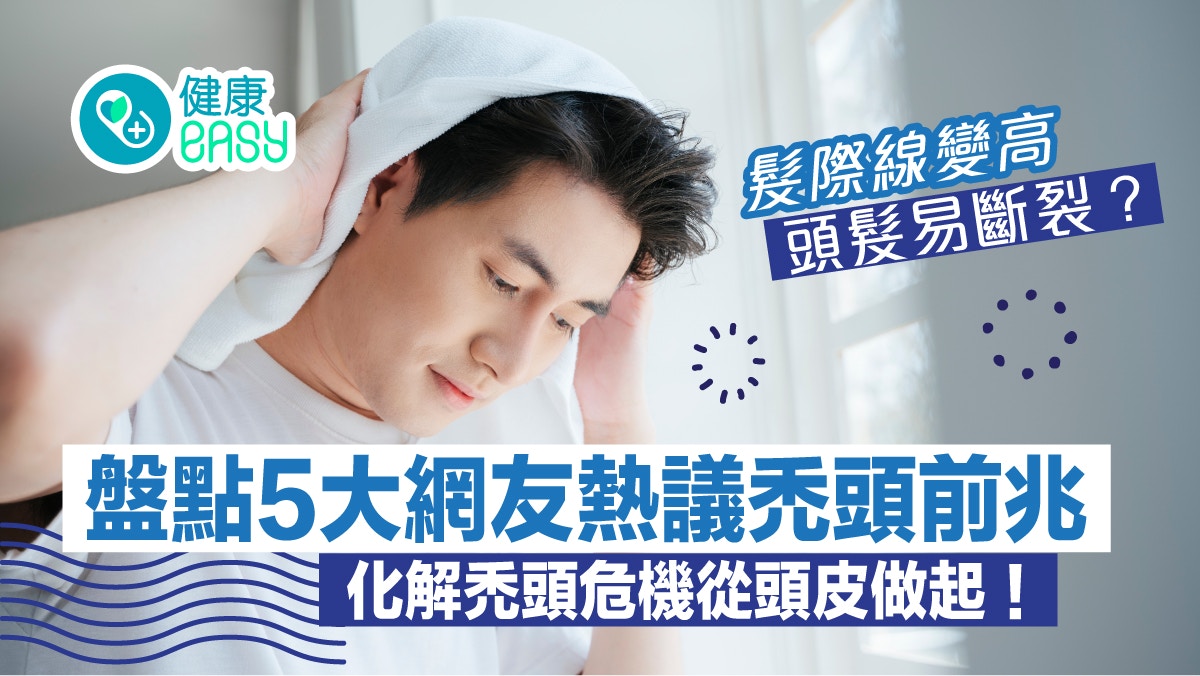 中年脫髮｜髮際線變高、頭髮易斷裂？盤點5大網友熱議禿頭前兆