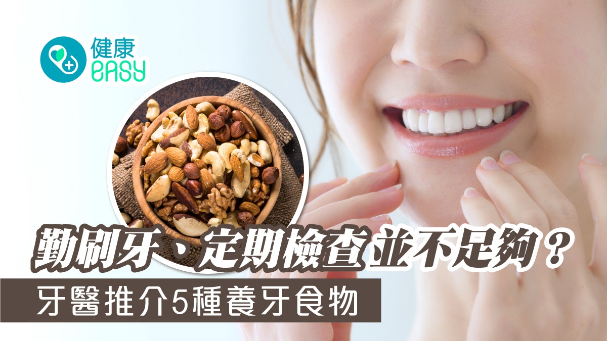 牙齒健康|如何維持口腔健康、不蛀牙?牙醫推介5種護齒食物 牙齒健康|如何維持口腔健康、不蛀牙?牙醫推介5種護齒食物