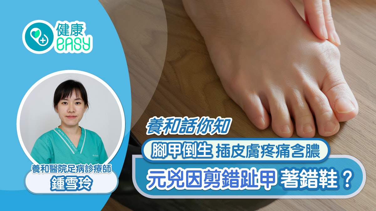 養和話你知丨腳甲倒生插皮膚疼痛含膿元兇因剪錯趾甲著錯鞋? 養和話你知丨腳甲倒生插皮膚疼痛含膿元兇因剪錯趾甲著錯鞋?