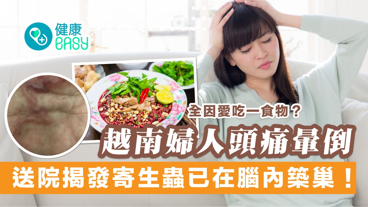 寄生蟲｜越南女愛吃一食物致寄生蟲體內橫行 送院揭寄生腦內築巢