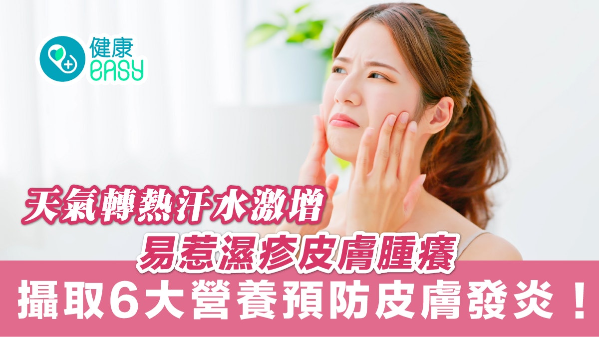 濕疹|天氣悶熱汗水多易引起濕疹皮膚腫癢 6大營養預防皮膚發炎 濕疹|天氣悶熱汗水多易引起濕疹皮膚腫癢 6大營養預防皮膚發炎