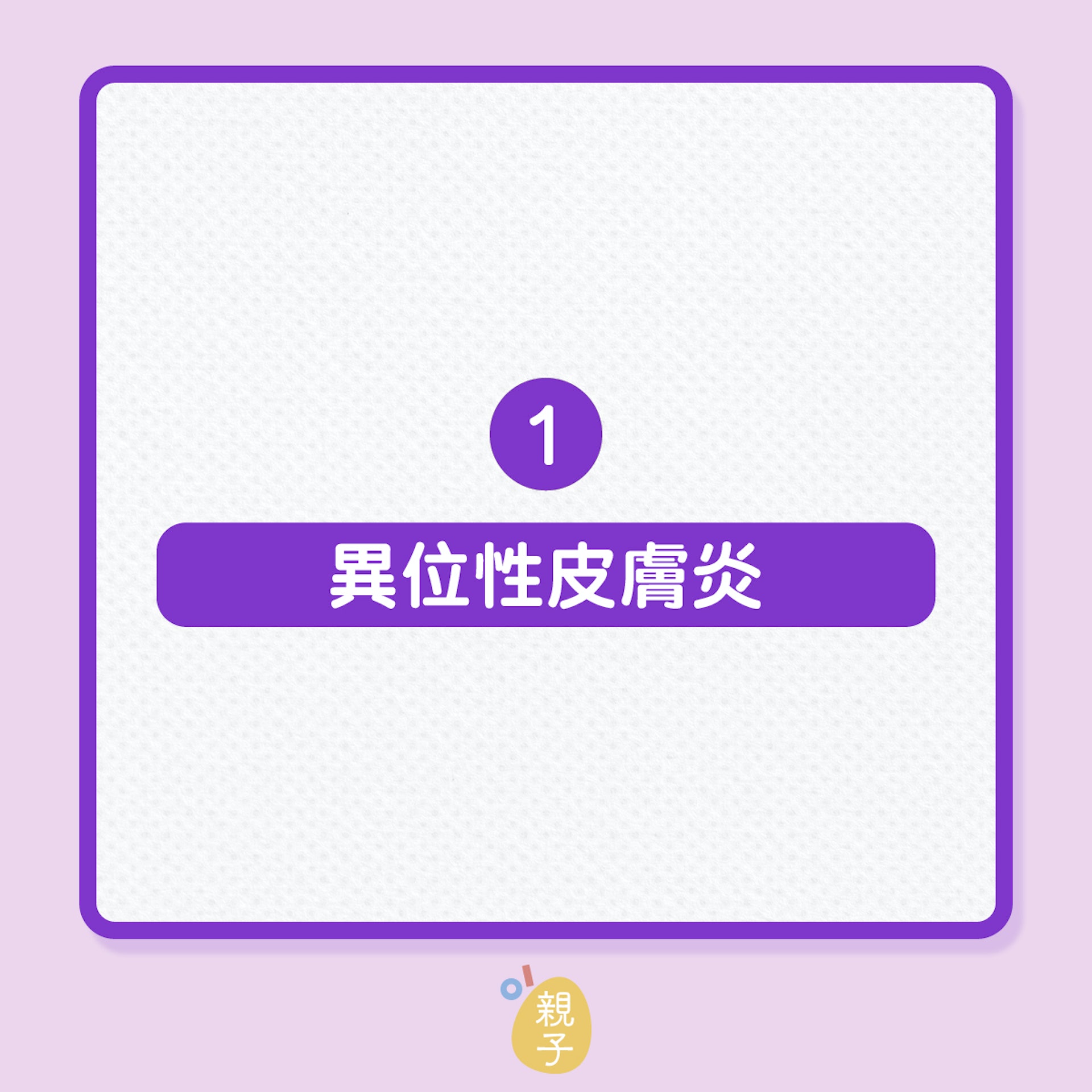 兒童健康|轉季時間,5種常見過敏疾病!(01製圖) 兒童健康|轉季時間,5種常見過敏疾病!(01製圖)