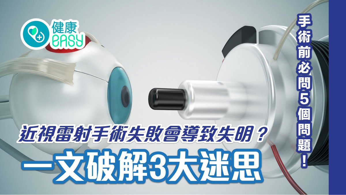 眼睛健康|近視雷射手術失敗會導致失明?一文破解3大迷思 眼睛健康|近視雷射手術失敗會導致失明?一文破解3大迷思