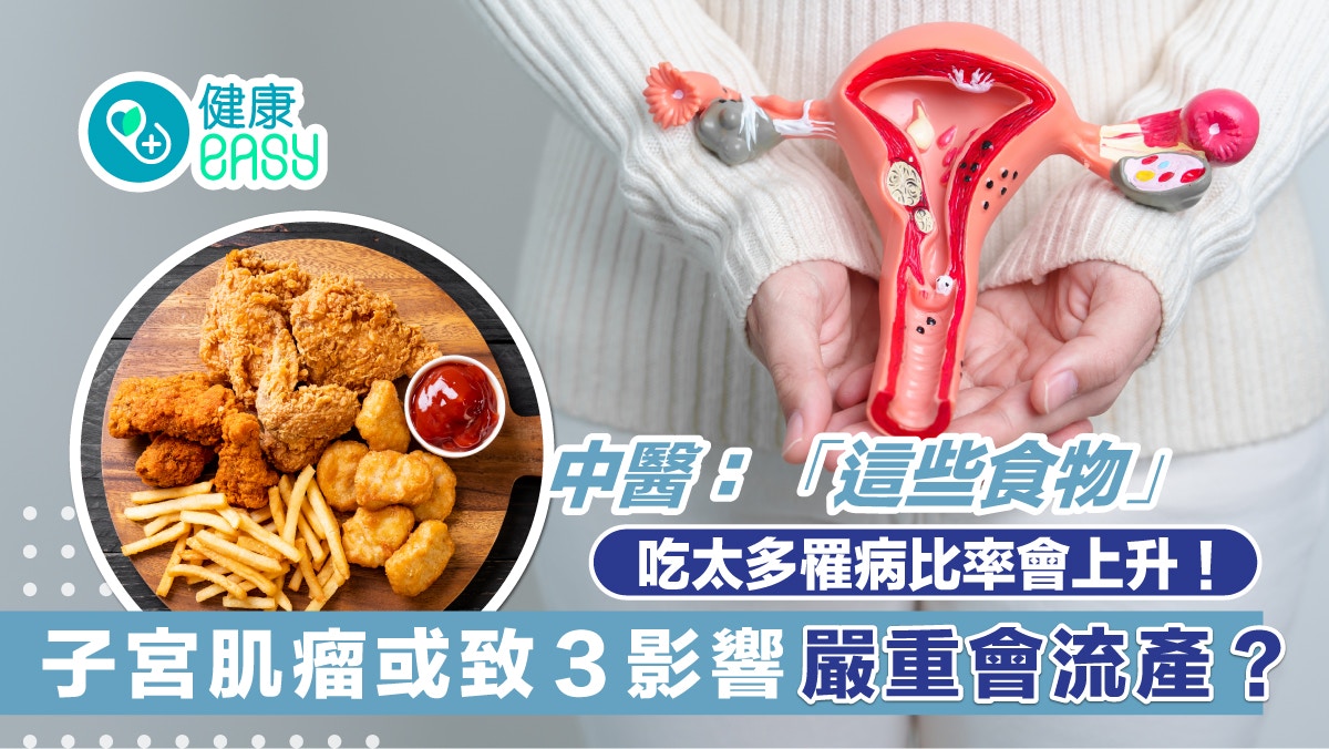 子宮肌瘤｜中醫揭3影響嚴重致不孕流產　這些食物會誘發子宮肌瘤