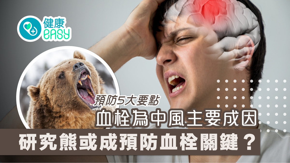 中風｜血栓為中風主要成因 研究熊冬眠或成預防關鍵？預防5大要點