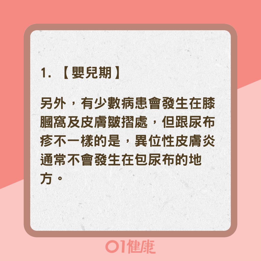 濕疹不同年齡症狀特徵大不同（01製圖）