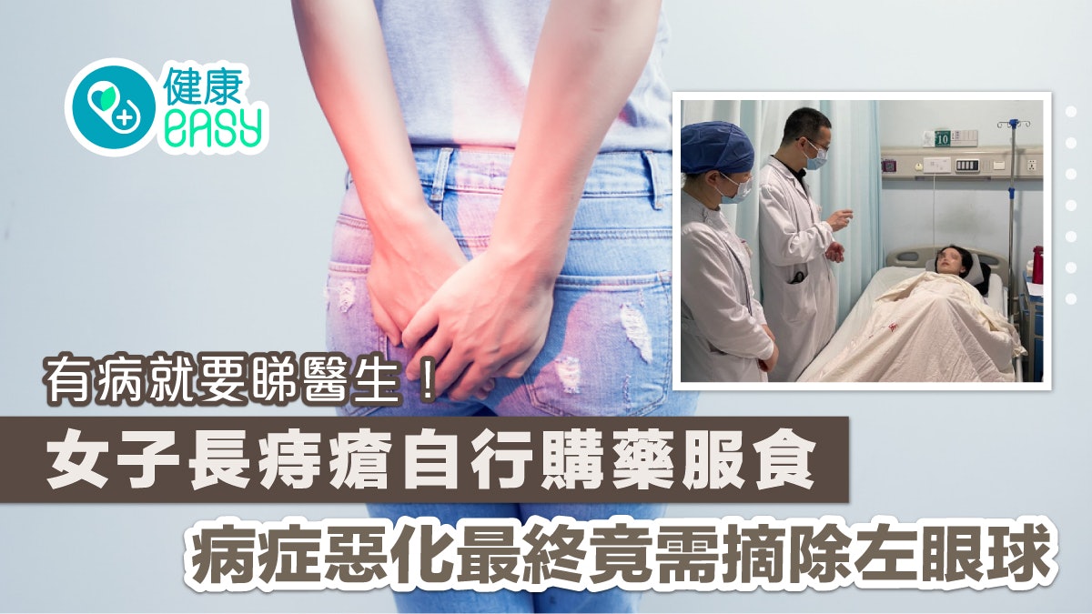膿毒症|女子長痔瘡無求醫 竟致膿毒症永久失去了左眼! 膿毒症|女子長痔瘡無求醫 竟致膿毒症永久失去了左眼!